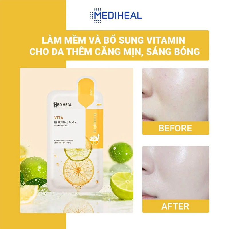 Hình ảnh minh họa củaMặt Nạ Mediheal Dưỡng Sáng, Mờ Thâm Cho Da Mụn 24ml Vita Brightening Essential Mask