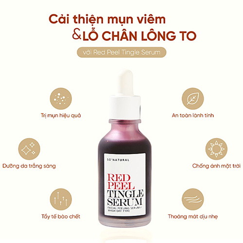 Hình ảnh minh họa củaTinh Chất Tẩy Da Chết Hóa Học So Natural Red Peel Tingle Serum 35ML