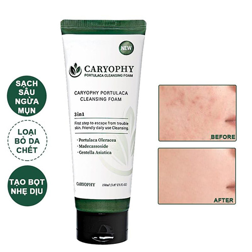 Hình ảnh minh họa củaSữa Rửa Mặt Sạch Sâu Caryophy Portulaca Cleansing Foam 150ml